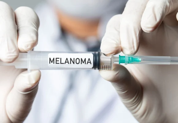 Vacuna melanoma